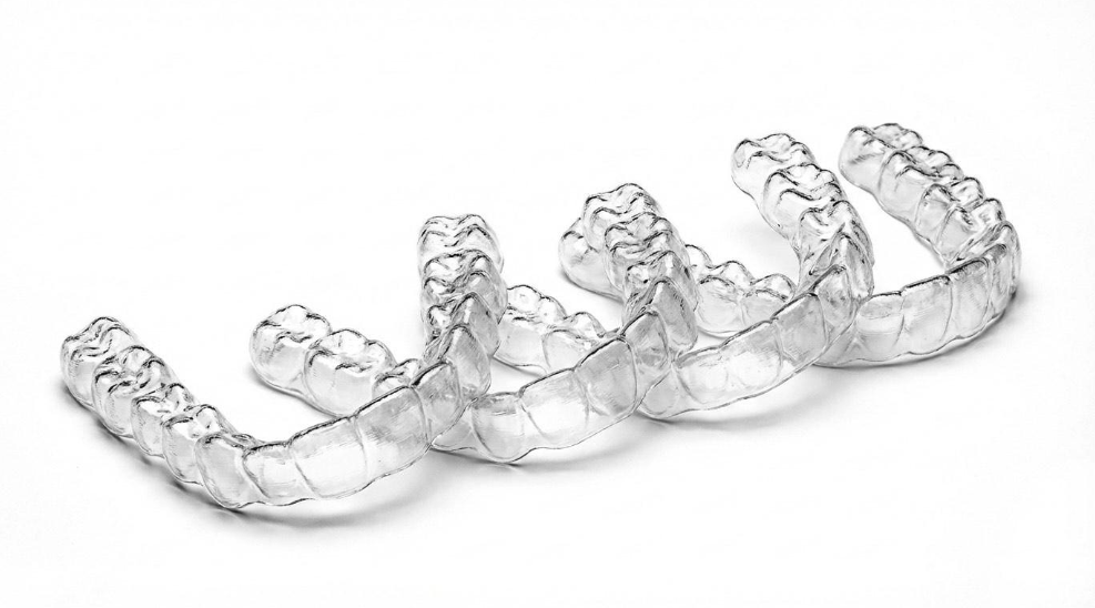 Aligneurs Français, Invisalign, Impress : comment comparer les aligneurs invisibles ?