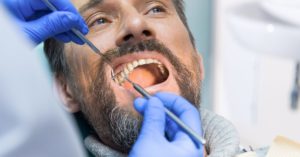 Aligneurs avec couronnes, implants ou facettes : est-ce compatible