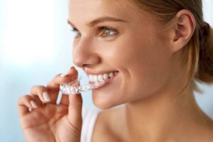 Mauvaise haleine avec des aligneurs : causes et bons gestes - Aligneurs Français
